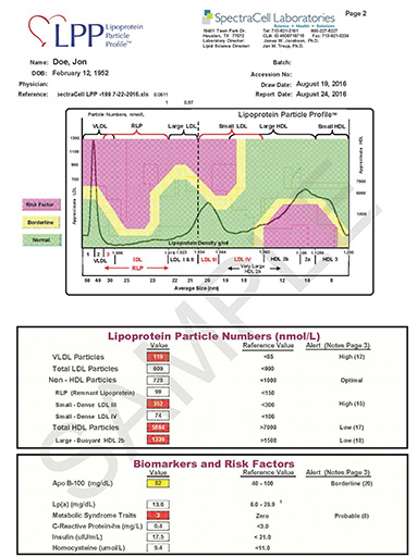 Comprehensive Cardiovascular Assessment Vancouver Vitalia Healthcare