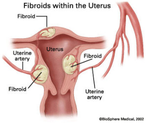 uterine