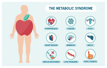 metabolic syndrome