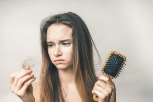 PCOS and Hair Loss