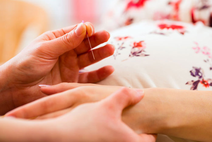 Acupuncture And Fertility Vitalia   Acupuncture Fertility 