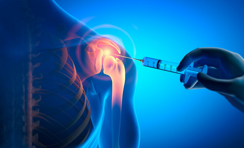 prp for joint treatment